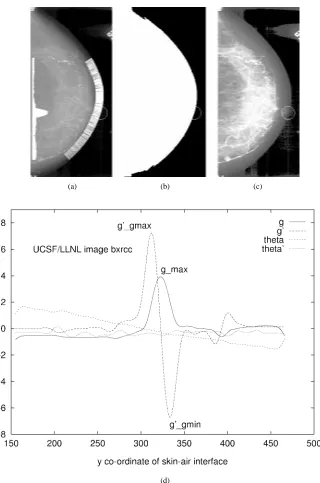 Fig. 6.UCSF/LLNL image bxrcc in cranio-caudal view with nipple not in proﬁle. (a) The intensities on the original mammogram have been transformedlogarithmically for display