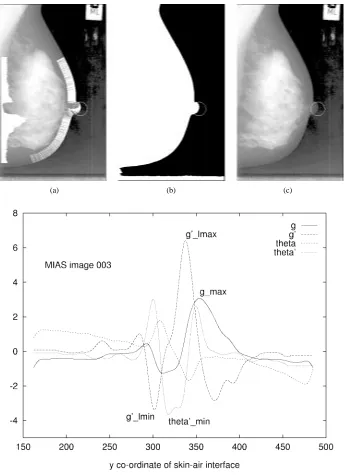 Fig. 3.MIAS image 003 in oblique view with nipple clearly in proﬁle. (a) The intensities on the original mammogram have been histogram-equalized.plotted against(b) Labeled image showing skin-air interface