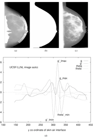 Fig. 4.logarithmically for display. (b) Labeled image showing skin-air interface. (c) This image has been histogram-equalized for display