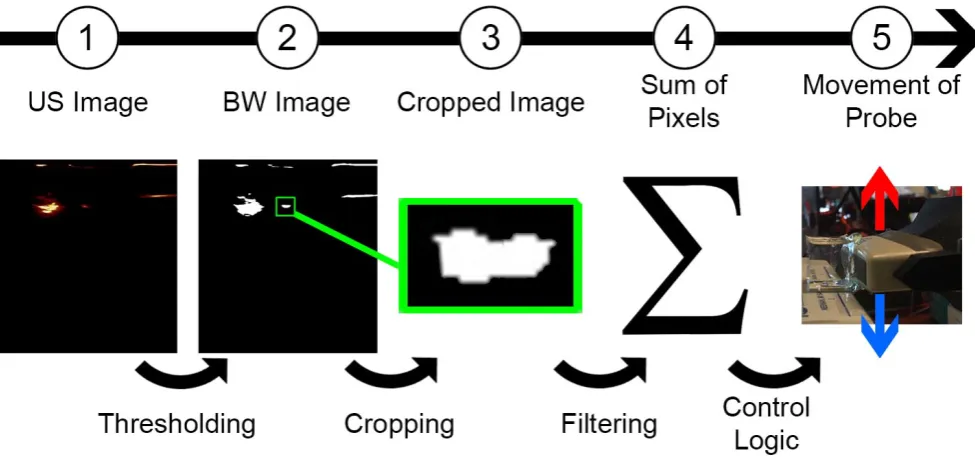 Fig. 8.The ultrasound image (1) is processed by thresholding based on the saturation of each individual pixel to receive a black-white image (2)