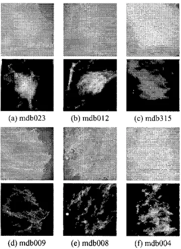 Fig. 2. (a-c) Original and highlighted images for circum- scribed masses. (d-f) Original and highlighted images for nor- mal breast tissue