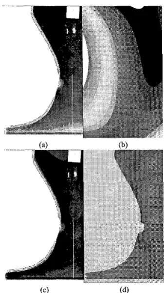 Fig. 6. Results of automatic segmentation. (a) Original MIAS mammogram mdb070rl. (b) Segmented breast border superim- posed on original mammogram