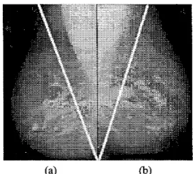 Fig. 10. Systematically searching for lesions using the nipple as the starting point and fanning into the breast is anatomically well founded