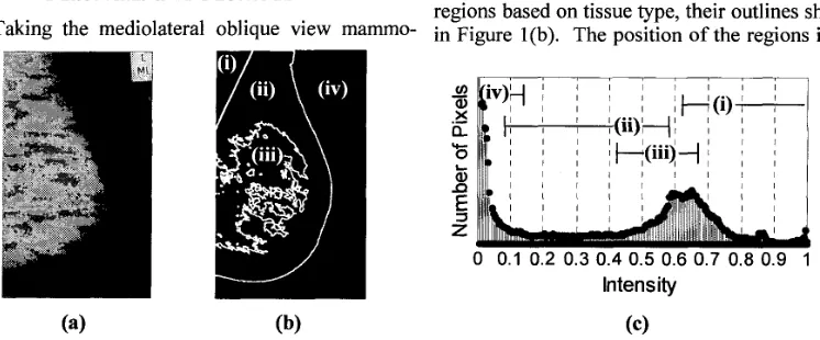 Figure 1: MIAS image mdb007 (a) has been decomposed into four tissue type regions (b)