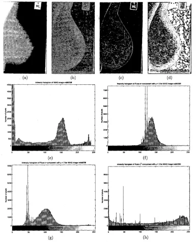 FIGURE 3: of the coefficients of correlation”, scaled with histogram of original mammogram sensitivity of the c-component which has been described elsewhere the extended q2 (b) This Images from the extended Russ operator with p = 3