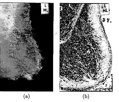 FIGURE 4: Images from the There middle has black parenchyma to the right extended Russ operator with p = 3
