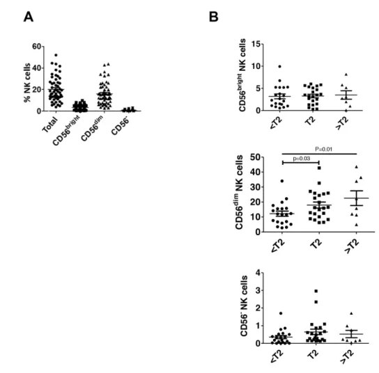Figure 3: CD56 dim  NK cells are increased in higher stage bladder tumors.  Human bladder tumor samples from n=50 patients  were processed into single cell suspensions and analyzed with flow cytometry as in Figure 1