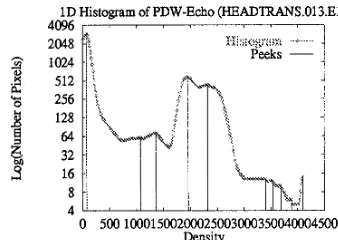 Fig. 2: One dimensional histogram of the PDW echo and its peaks. 
