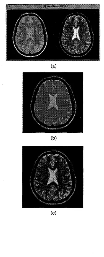 Fig. 1: Segmentation of an actual dual-echo MR images with the improved ARTZA network with B = 0.05,p = 0.80