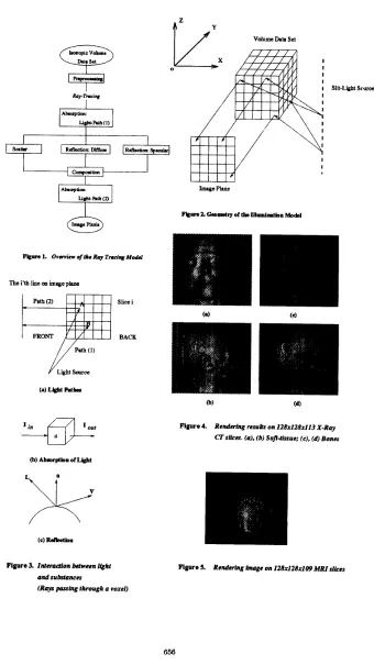 Figure 4. Rendering nsul* on 128~128x113 X-Roy Sofi-ltssue; IC). 
