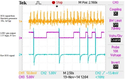 Figure 2.24: AC Leads off Detection