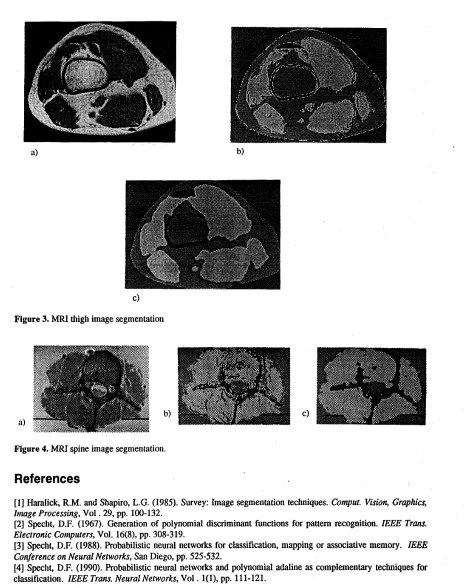 Figure 3. MRI thigh image segmentation 
