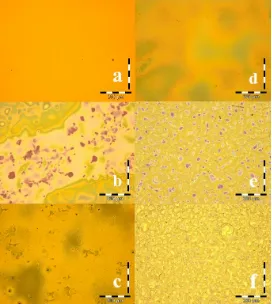 Figure 7. Optical (top) and AFM (bottom) surface profile of P3HT-PCBM in chlorobenzene prepared by spray coating