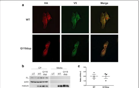 Fig. 3 Cellular characterization of p.Q118dup BMP6 protein in a hepatic endothelial cell model, SK-HEP-1.transfected SK-HEP-1 cells