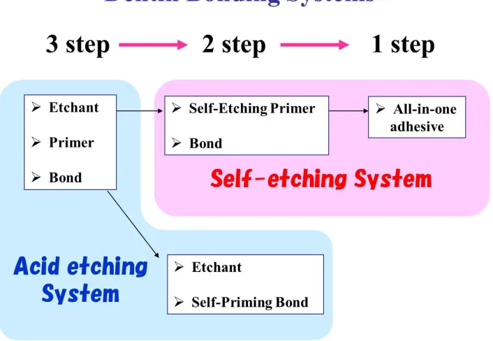 Figure 2. Classification of dentin bonding systems; Dentin bonding systems are improved  and simplified