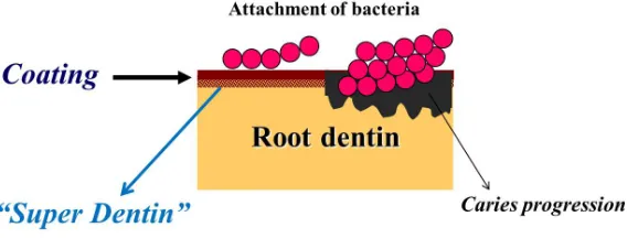 Figure 8. Surface coating strategy in the future; Surface coating can provide a strong physical barrier with the formation of “Super Dentin” and also “Super Enamel” for protection against caries, erosion and abrasion