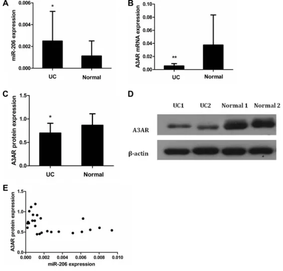 Figure 1: Expression and correlation of miR-206 and A3AR in UC tissues.  Expression in UC and normal tissues of (A) miR-206,   (B) A3AR mRNA, and (C) A3AR protein