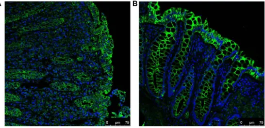 Figure 2: IF staining for A3AR (FITC; green) and counterstaining of nuclei (DAPI; blue) in UC (A) and normal (B)  colonic tissues