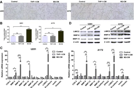 Figure 2: M2-like macrophages drive VM formation of glioma cells in vitro.  The glioma cells were incubated in the conditioned  medium (CM) from THP-1 or M2 cells for 24 h