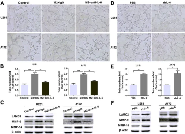 Figure 4: IL-6 upregulation is responsible for VM promotion in glioma cells.  (A, B) Glioma cells were treated with DMEM  medium or M2-CM in the presence or absence of anti-IL-6 at 1 μg/ml, or isotype-matched IgG (IgG) control for 24 hours