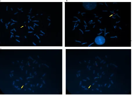 Figure 2a) The use of the Alpha satellite probe, specific for a region including the centromere and spanning from Yp11.1 to Y q11, revealed 