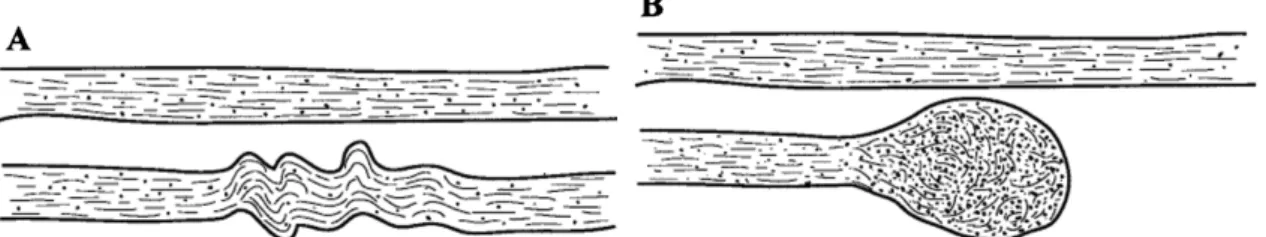 Figure  4-1.  Axons  before  and  after  cytoskeletal  disruption  due  to  mild  TBI