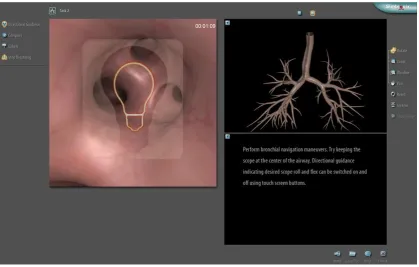 Figure 6. Simulator task 2. Guided Anatomic Navigation (Simbionix, 2018a).  