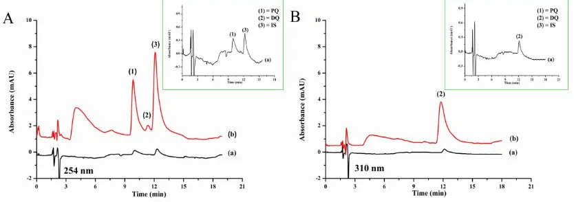 Figure 3.Figure 3.  ((AA) Transmission electron microscopy (TEM) images and () Transmission electron microscopy (TEM) images and (BB) particle sizes of SUPRAS.) particle sizes of SUPRAS