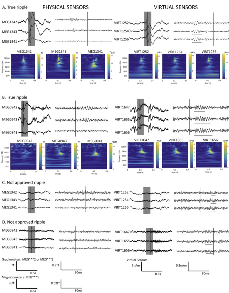 Fig. 4. Examples of ripples that were approved (A + B) and not approved (C + D) during the visual check
