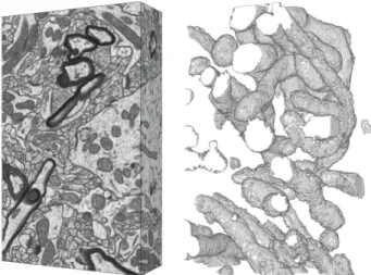 Fig. 7. Left. A second isotropic stack of neural tissue, similar to the one show in Fig