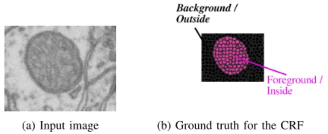 Fig. 2. The input image (a slice through a 3D volume) is shown in (a). Figure (b) shows the ground truth labeling of the CRF used in our method
