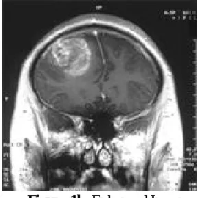 Figure 1a.                       Input Image                                           Figure 1b