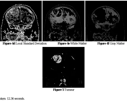 Figure 5 Tumour 