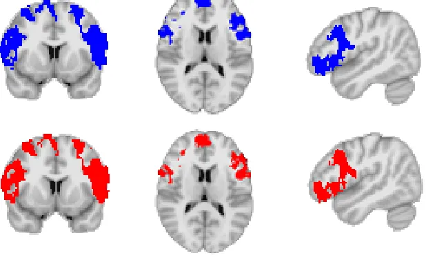 Figure 2: Comparison of parametric (in blue) and randomization (in red) derived p-values.The parametric map is thesholded at pp<0.003; the randomization map is thresholded at<0.05