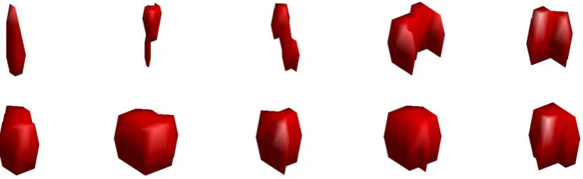 Figure 9  illustrates shapes of DWMH lesions with increasing eccentricity. Differences in eccentricity are difficult to assess visually