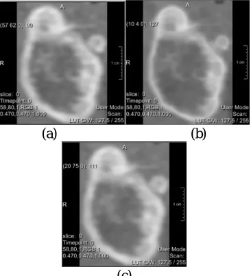 Figure 4 ROI selection process (a) ROI selection (b) extracted region 