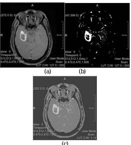 Figure 9 Clustering segmentation without pre-processing (a) Original image, (b) and (c) segmented image