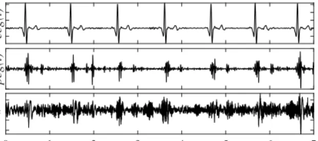 Fig. 1. Synchronous signals. From top to bottom: ECG, PCG and noisy PCG.
