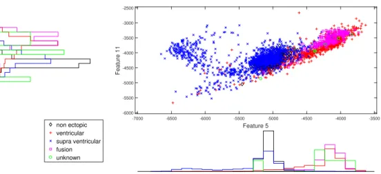 Figure 4. Scatter plot with marginal histogram for log entropy (IMF1) vs. log entropy (IMF2).