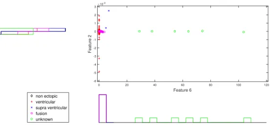 Figure 7. Scatter plot with marginal histogram for norm entropy (IMF1) vs. CUM2 (IMF1).