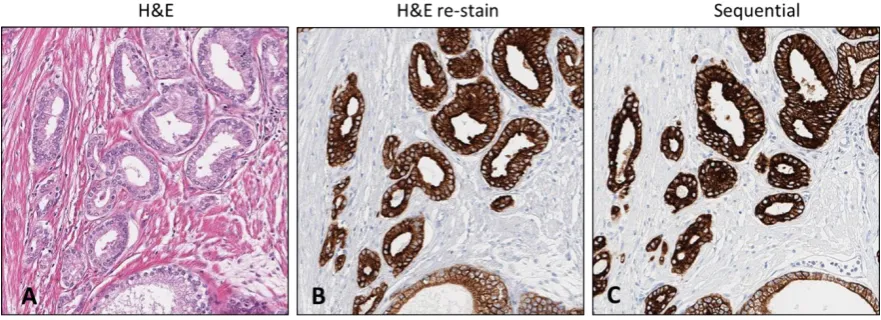 Table 4. Comparison of H&E re-used and sequential comparator immunostaining intensity scores.