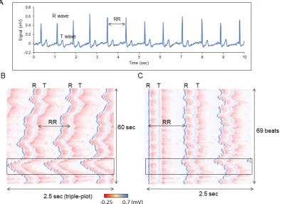 Figure 11.B) Time course data ofthe blood glucose level on Day 6 is extracted from the chronogram