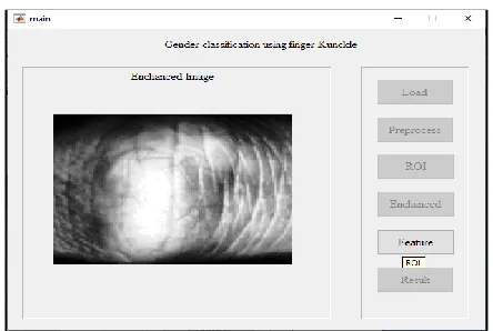 Fig 3.ROI sub image. 