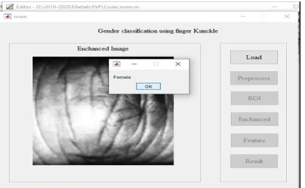 Fig 7. Result for Gender classification of knuckle image. 