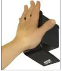 Figure 1 New palm vein knob 