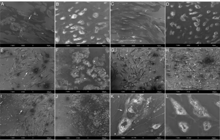 Figure 1: HR-SEM analyses.  HF control at 24 h (Bar: 10 µm) A. Flat and elongated morphology (arrow)