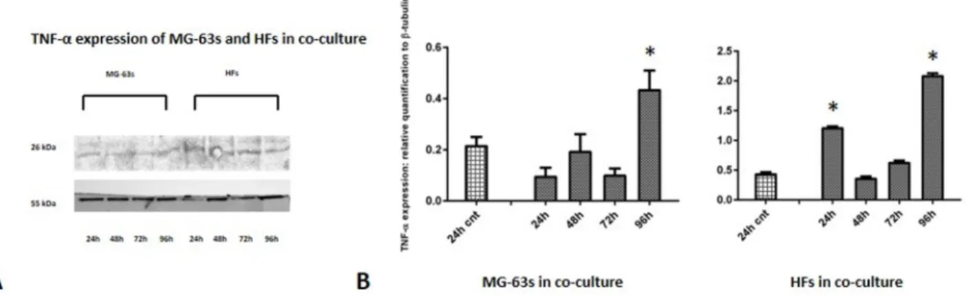 Figure 3: Western blot for TNF-α.  Densitometric analysis A. TNF-α expression in co-cultured HFs and MG-63 cells B