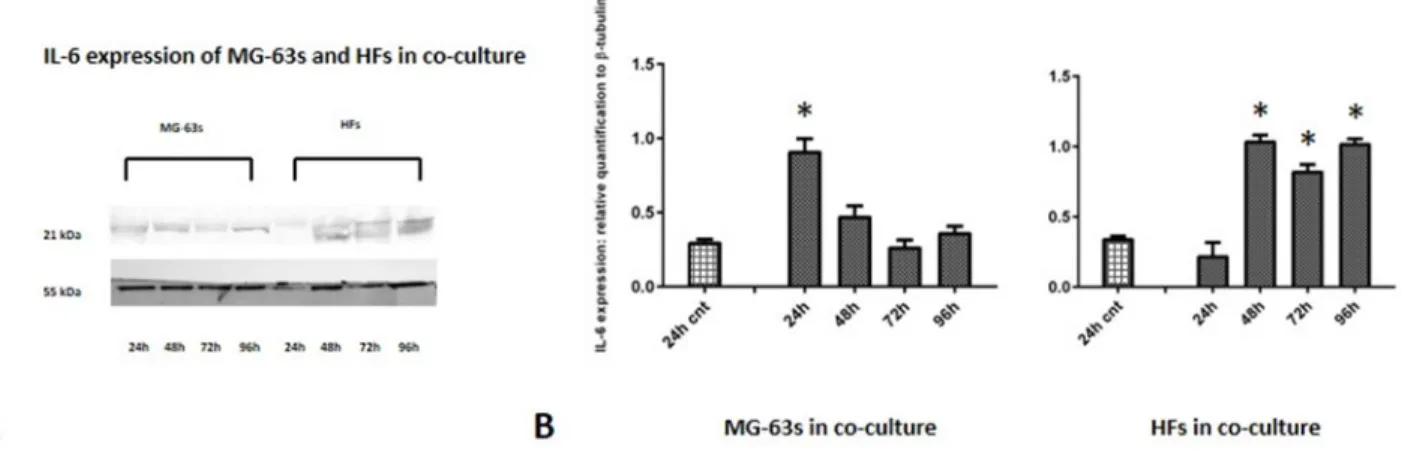Figure 4: Western blot for IL-6.  Densitometric analysis A. IL-6 expression in co-cultured HFs and MG-63 cells B