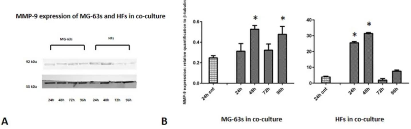 Figure 7: Western blot for MMP-9.  Densitometric analysis A. MMP-9 expression in co-cultured HFs and MG-63 cells B