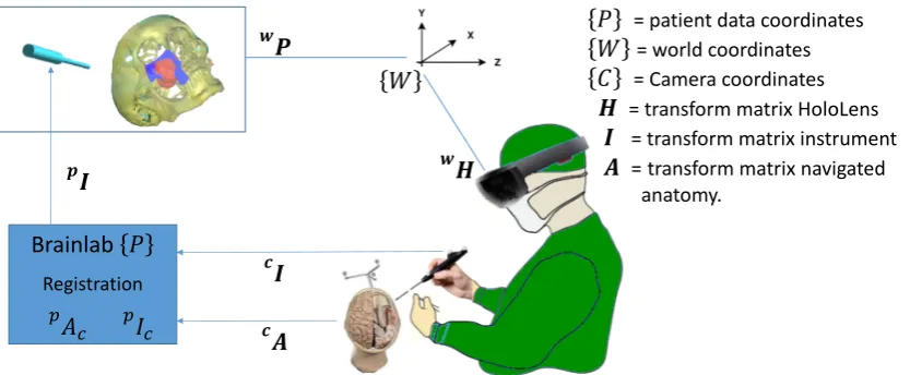 Figure 4. Showing the coordinate systems and their transforms. The HoloLens and Brainlab use different coordinate  systems with an unknown relation